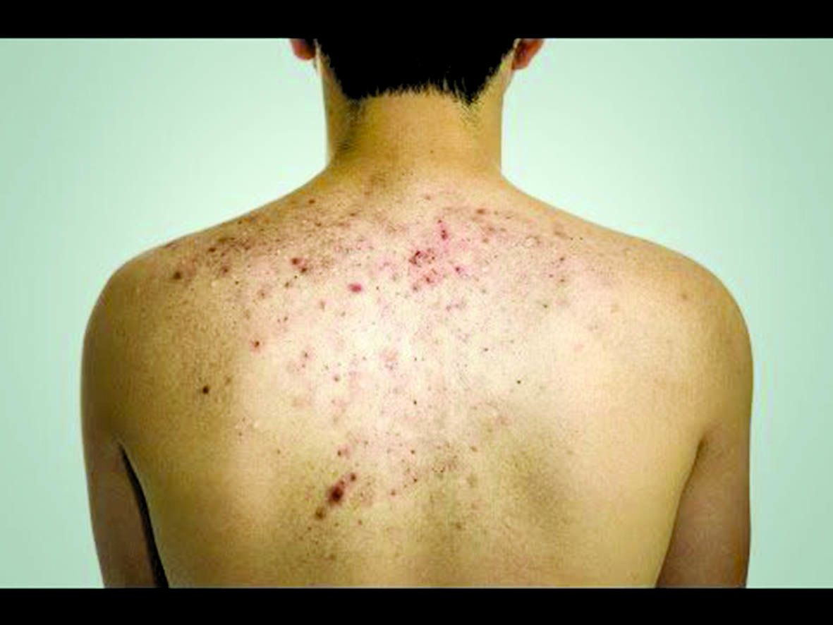 «الرعاية» تطرح نصائح لمرتادي الشواطئ