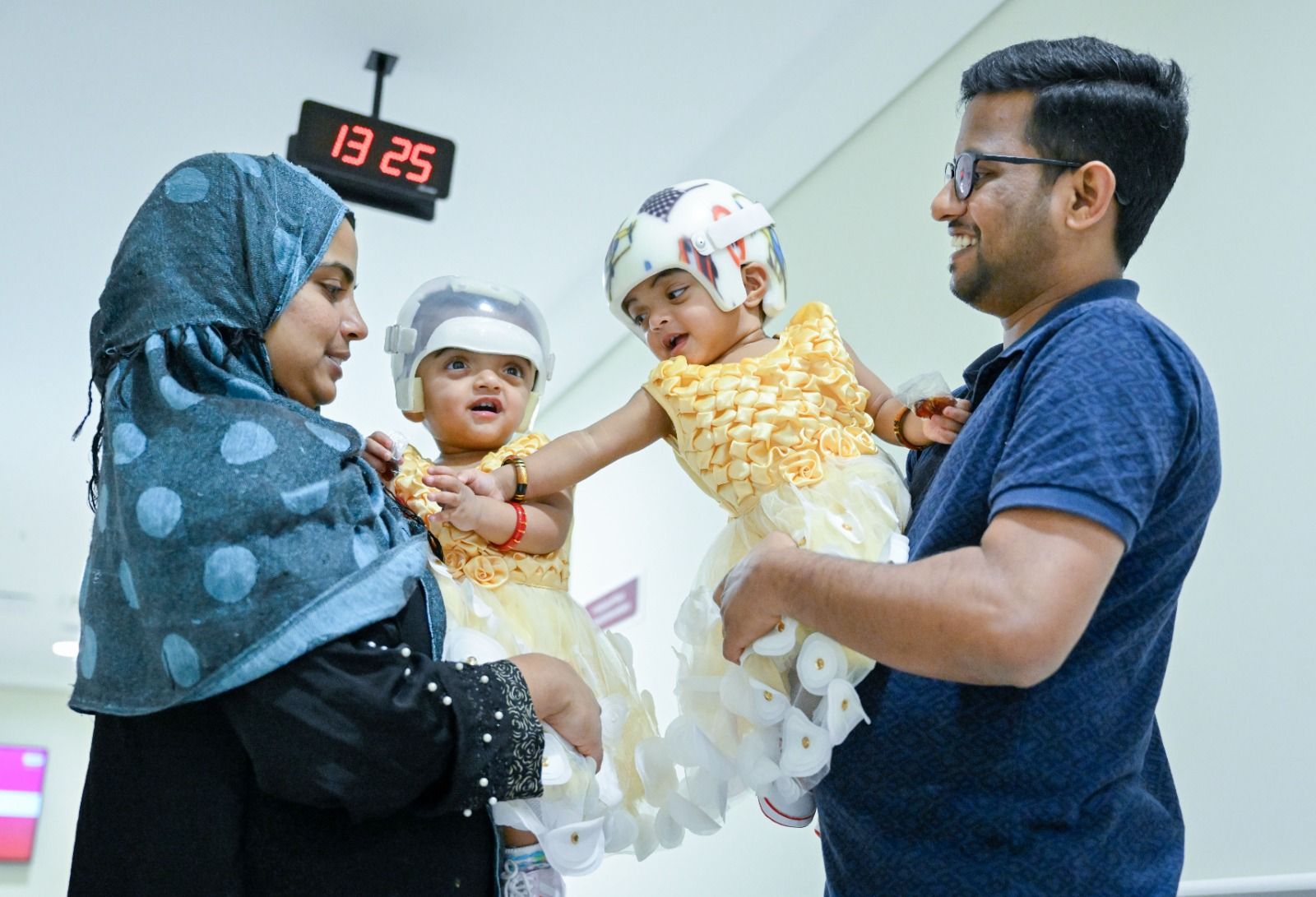 جراحة معقدة في برجيل الطبية لتوأم عانى من تشوهات الجمجمة