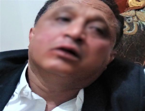 بعد إغلاق إذاعته بصنعاء.. عصابة حوثية تعتدي بالضرب المُبرح على صحفي أمام منزله