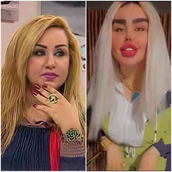 بسبب جراحات التجميل.. إعلامية عراقية تتصدر الصحف العالمية (صور)