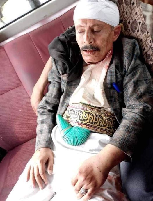 إب.. مُعلّم يتعرض للاعتداء الوحشي وسرقة سلاحه (الجنبية) أثناء عودته من مدرسته