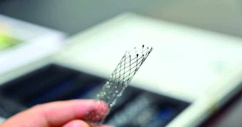 تركيب أول دعامة مائلة في الكويت لحالة نادرة مُصابة بـ«ماي ثيرنر»