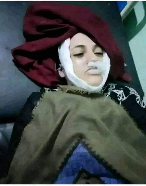 ناشطون يتحدثون عن مقتل فتاة حقنًا بالسمّ لرفضها الزواج من أحد أقاربها بـ"تعز"