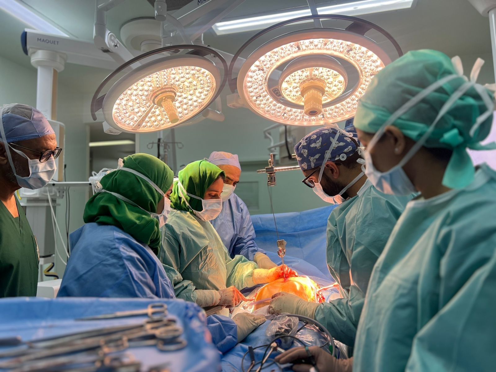 تدشين برنامج ترميم القفص الصدري بالمنظار الجراحي لأول مرة في سلطنة عُمان