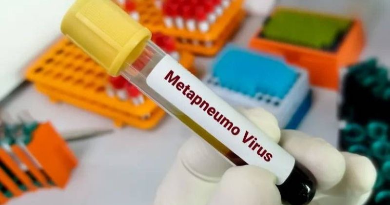 «الصحة»: معدلات الإصابة بفيروس «HMPV» في الكويت مستقرة