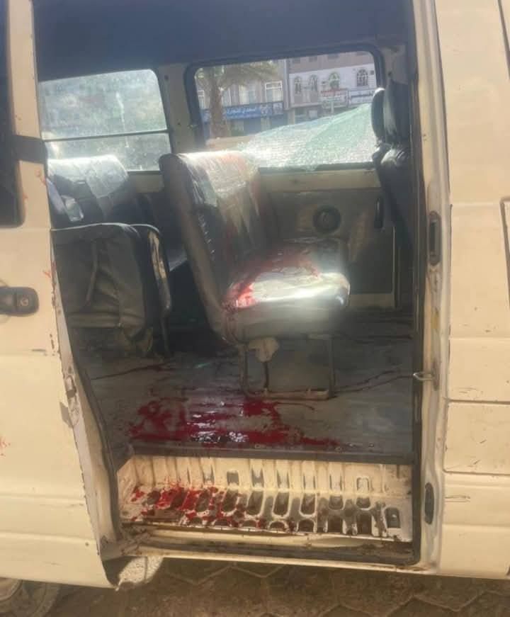 بسبب خلافات أسرية.. مقتل امرأة برصاص زوجها وسط مدينة عدن