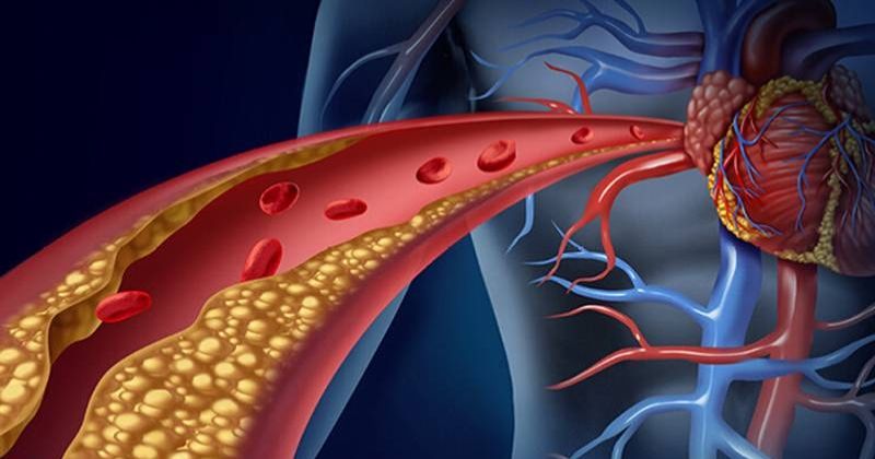 «الصحة» عن معلومات «فيديو أدوية الكوليسترول»: غير دقيقة ومضللة