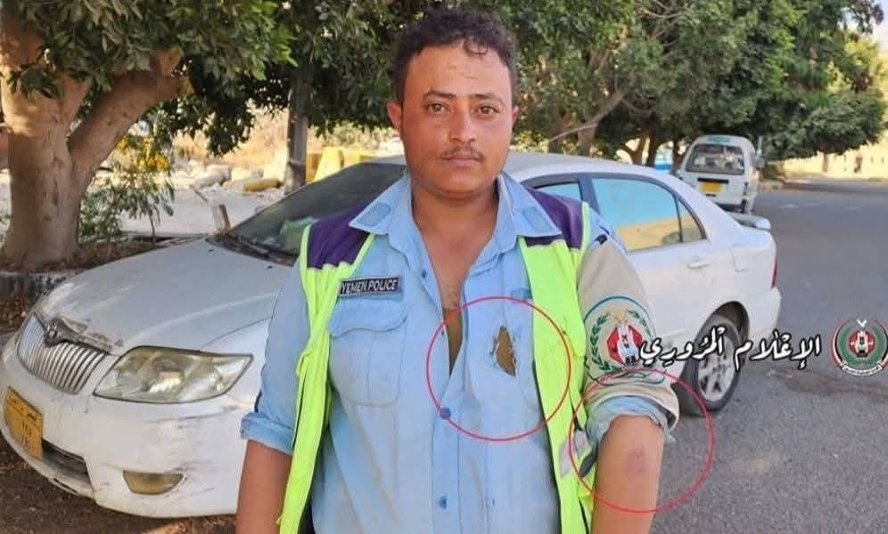 الحوثيون يعتدون على سائق باص في صنعاء ويبررون الحادثة
