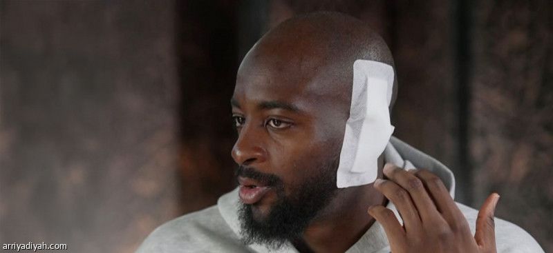 ماتيتا: جادلت الطبيب.. ووليام اعتذر برسالة