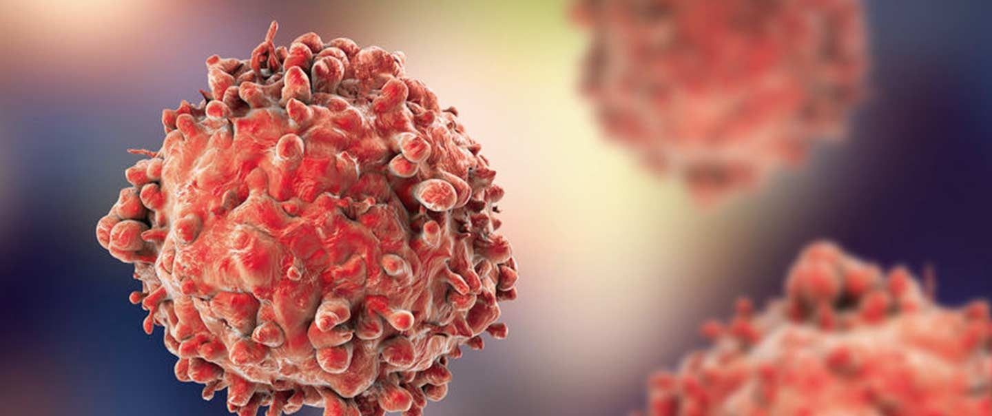 هل هناك صلة بين التوتر والسرطان ؟