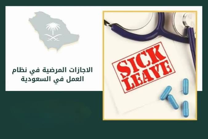 كم عدد أيام الإجازة المرضية المسموح بها في قانون الخدمة المدنية