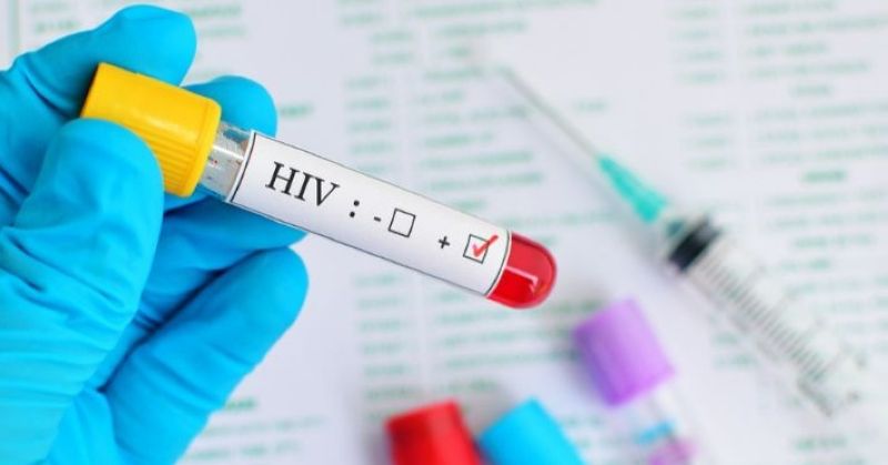 اعتماد فحص «الإيدز» ضمن إجراءات مراكز التأهيل وعلاج الإدمان.. والإبلاغ إلزامي